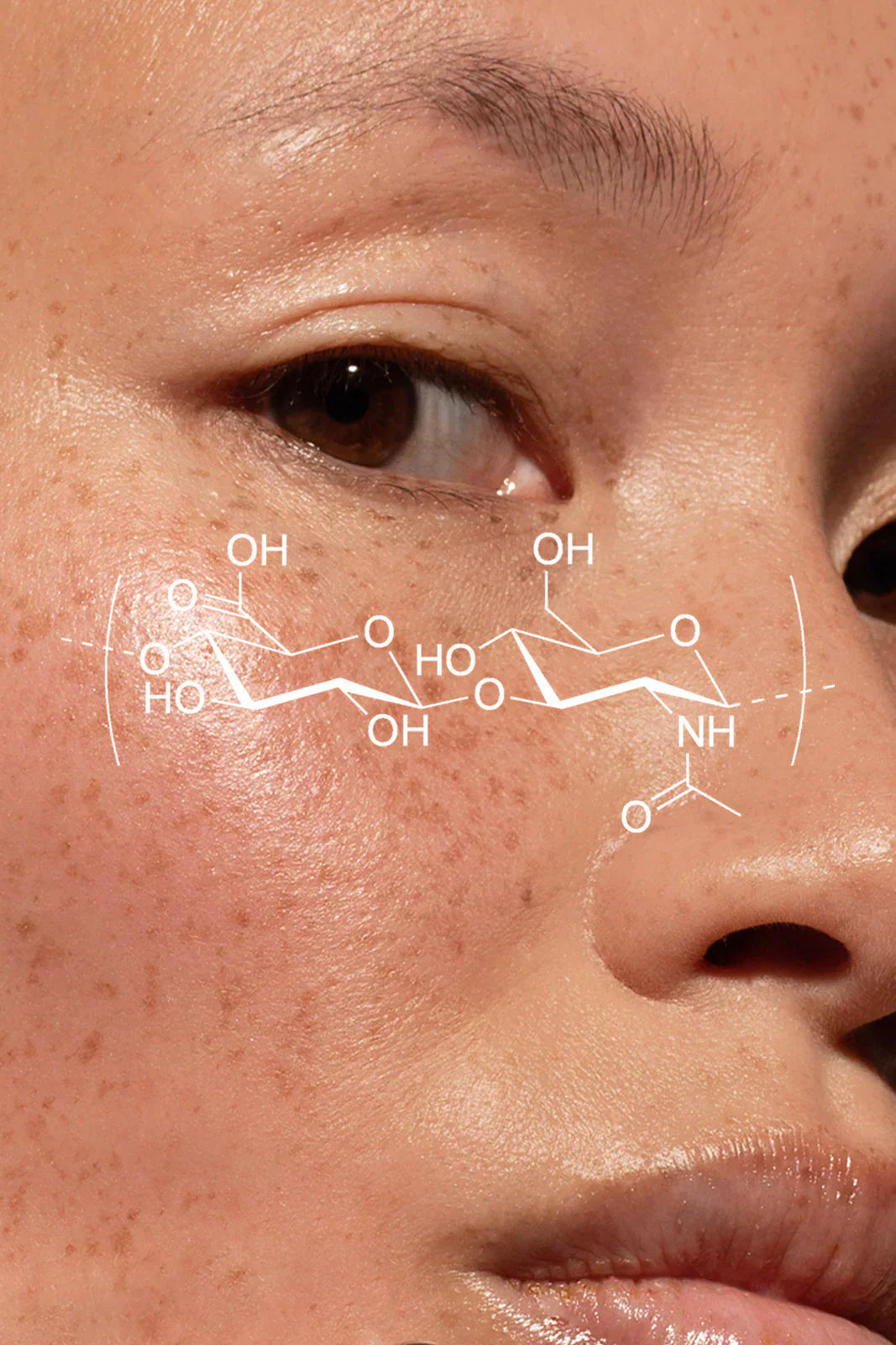 L'acide hyaluronique