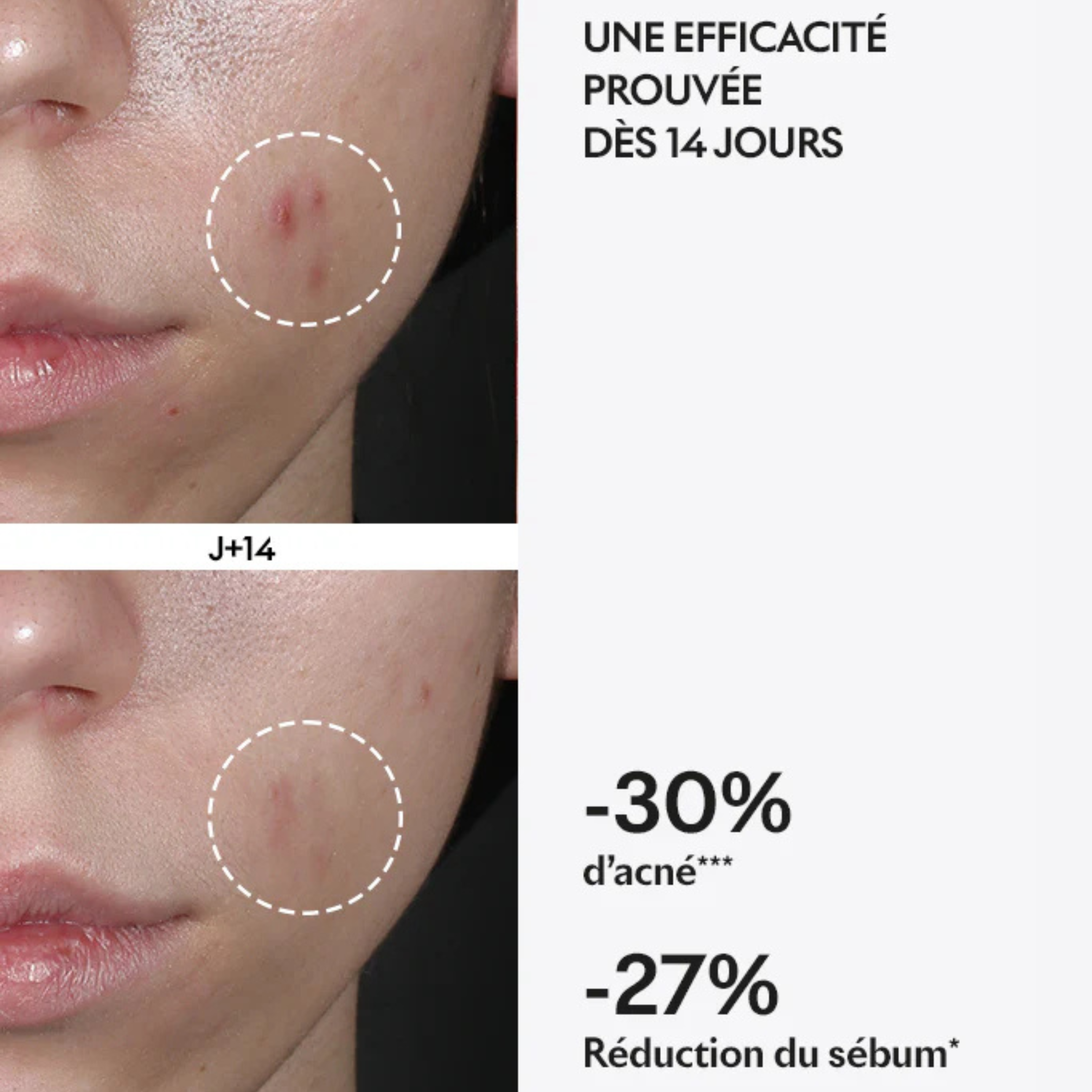 Capsule Purity - Blemished skin