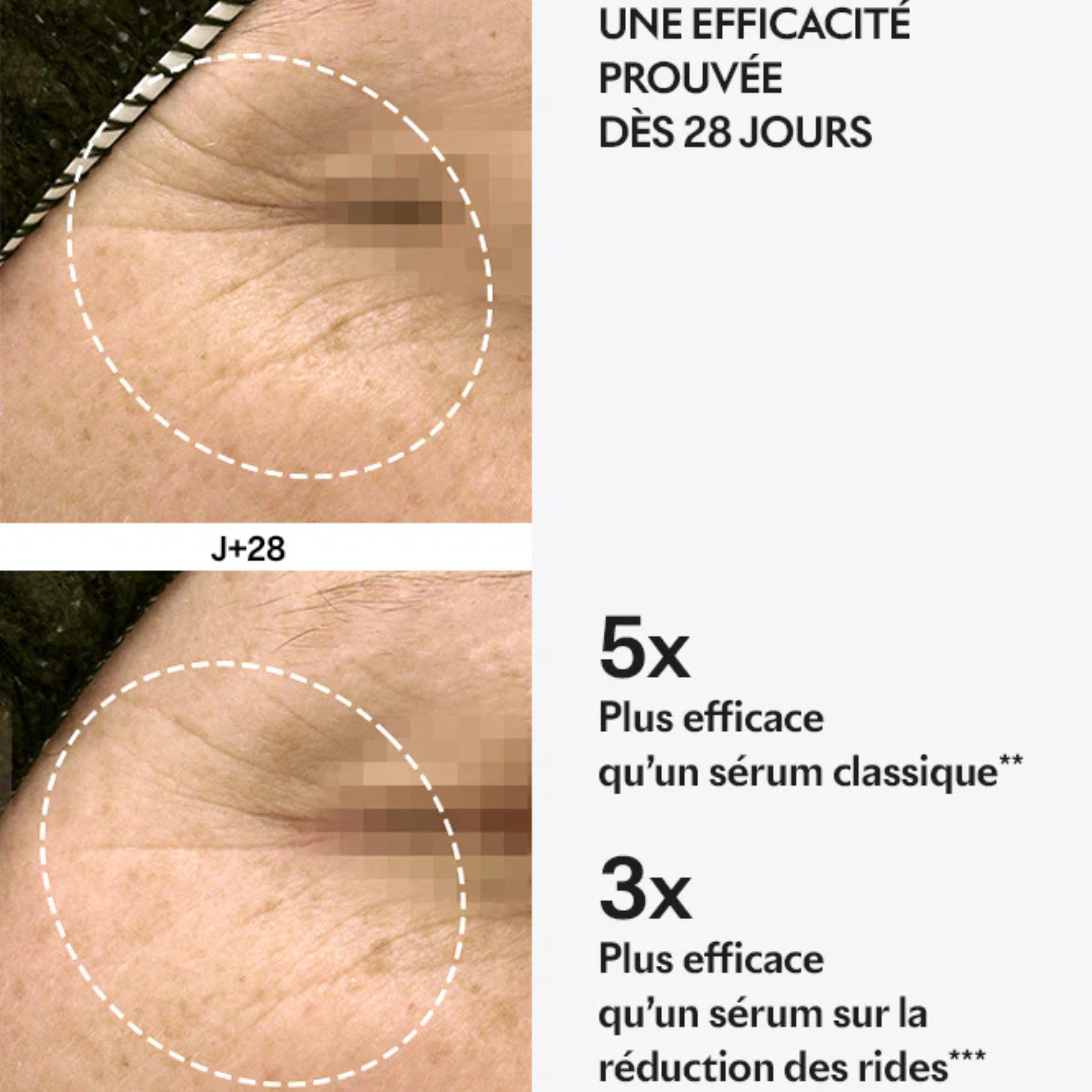 Capsule Repair - Mature skin