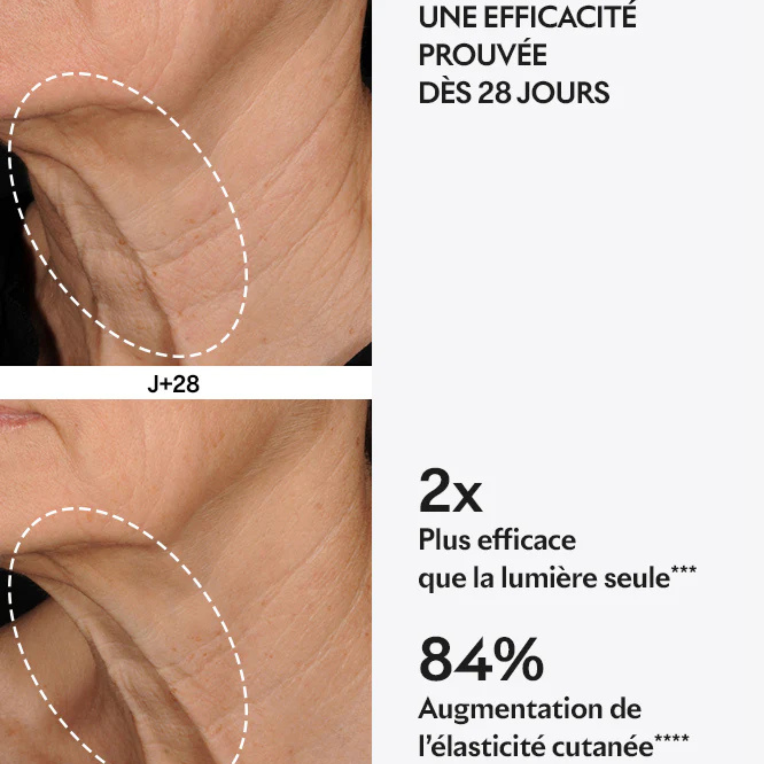 Small LIFT capsule pouch