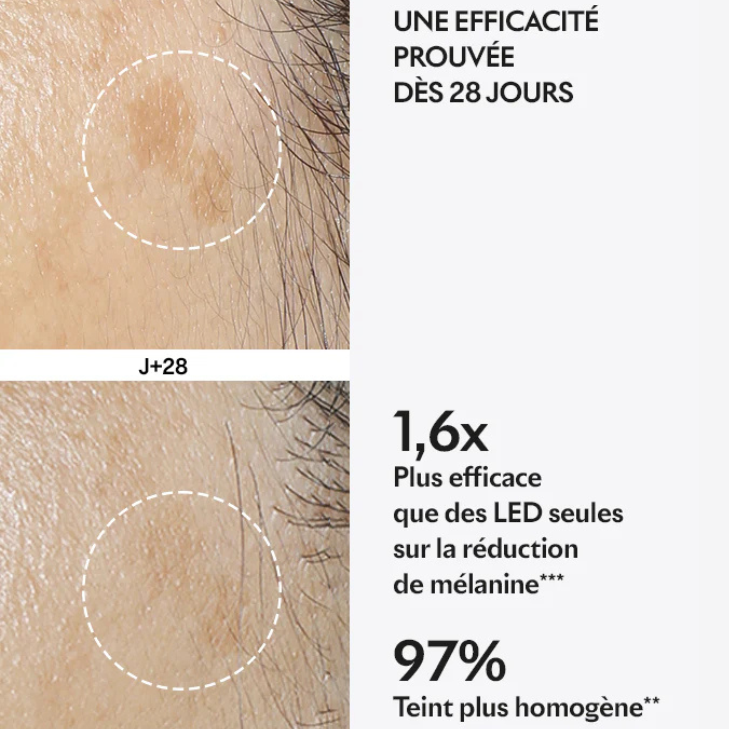 Capsule Spotless - Pigmentation spots